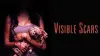 Visible Scars