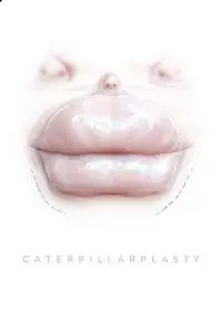 Poster to the movie "Caterpillarplasty" #1021456