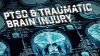 Backdrop to the movie "Joel Hunt: Traumatic Brain Injury (TBI)" #1198084