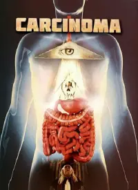 Poster to the movie "Carcinoma" #1167494