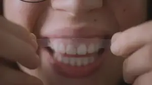 Backdrop to the movie "Des dents blanches... au rire jaune !" #774158