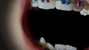 Backdrop to the movie "Open Wide" #761419