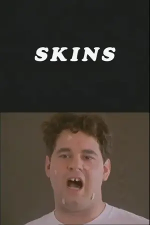 Skins