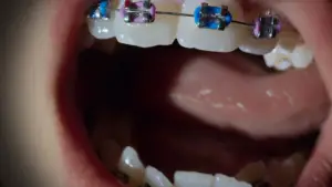 Backdrop to the movie "Open Wide" #761416