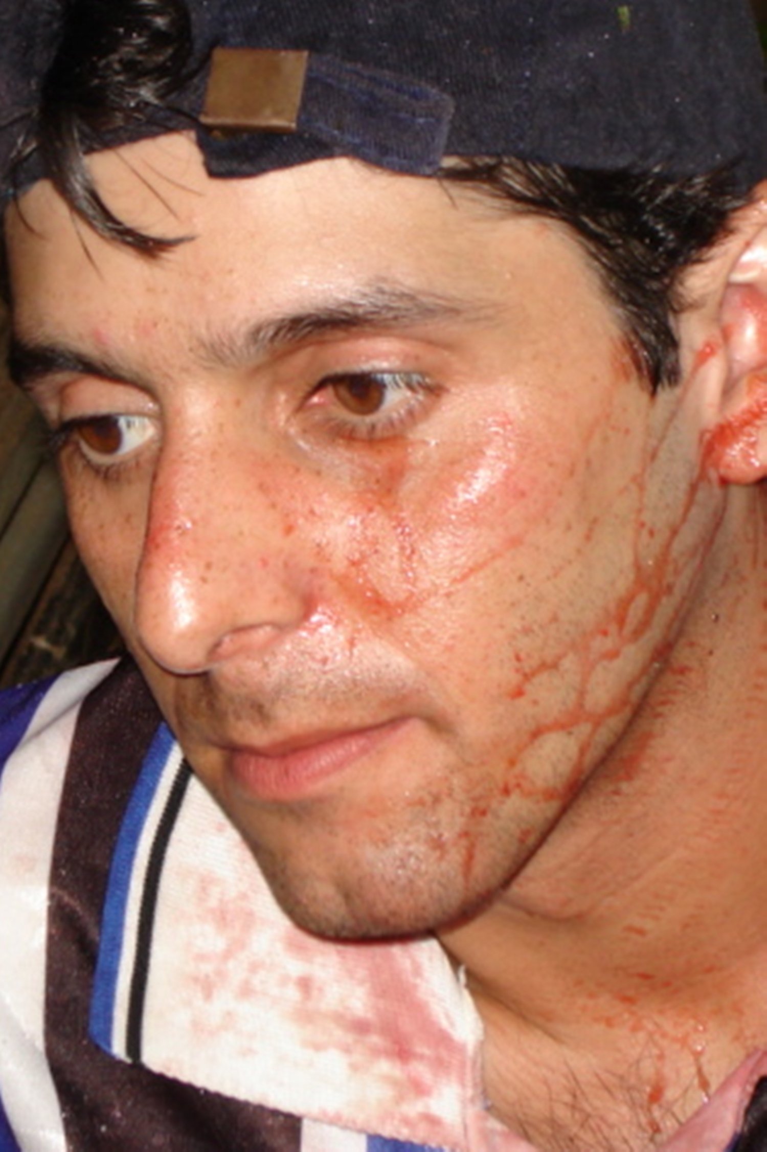 Photo Everson Schütz