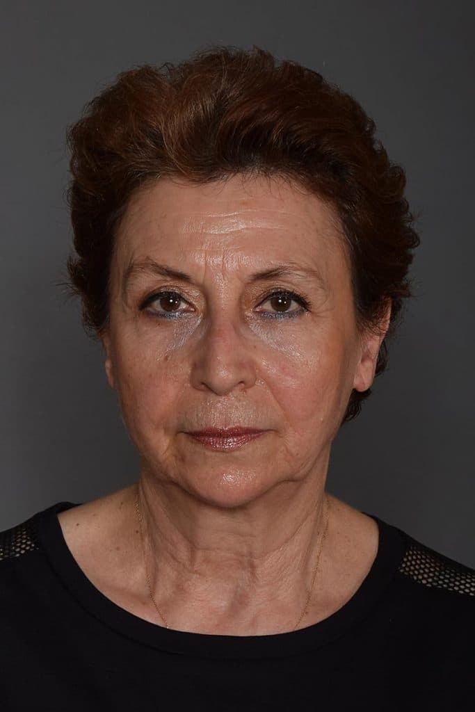 Photo Serra Menderes