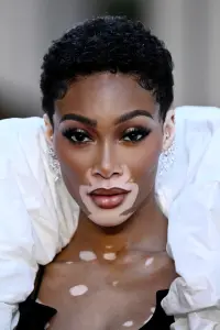 Photo Winnie Harlow
