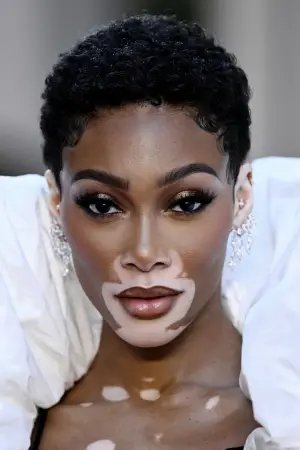 Photo Winnie Harlow #330233