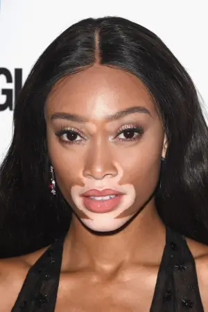 Photo Winnie Harlow #330232