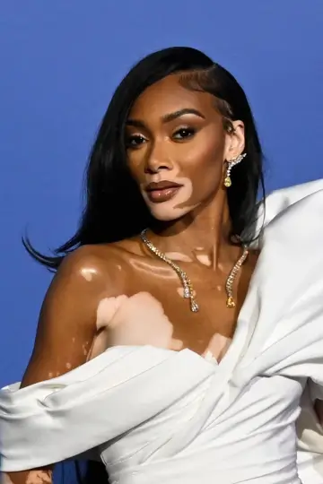 Photo Winnie Harlow #155993