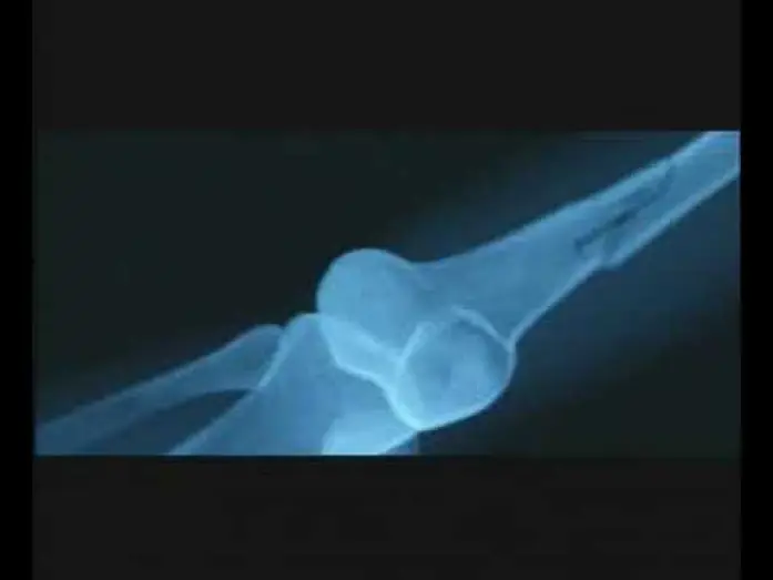 Watch film Fragile — Fragile - Trailer Italiano (2005)