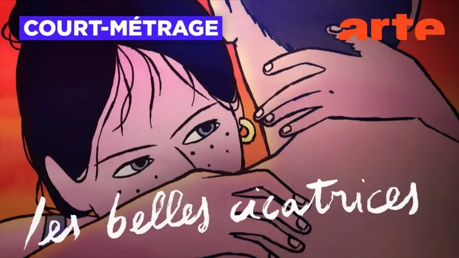 Watch film Scars We Love — Les belles cicatrices | Court-métrage | ARTE