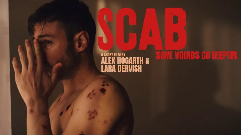 Watch film Scab — SCAB | Official Teaser | Body Horror