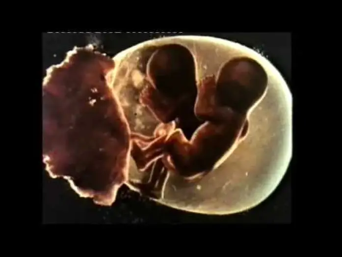Watch film Sisters — Sisters (1973) - Trailer
