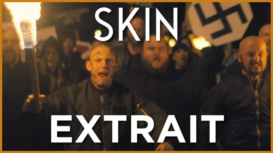 Watch film Skin — SKIN - Extrait VOST