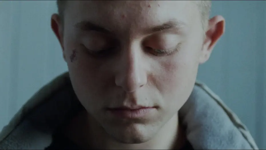 Watch film Skunk | Skunk - Official Trailer