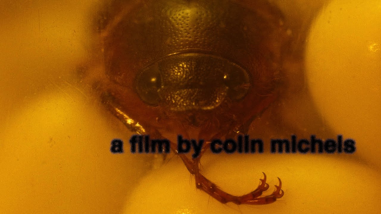 Watch film i have eczema and i'm scared of bugs | i have eczema and i'm scared of bugs