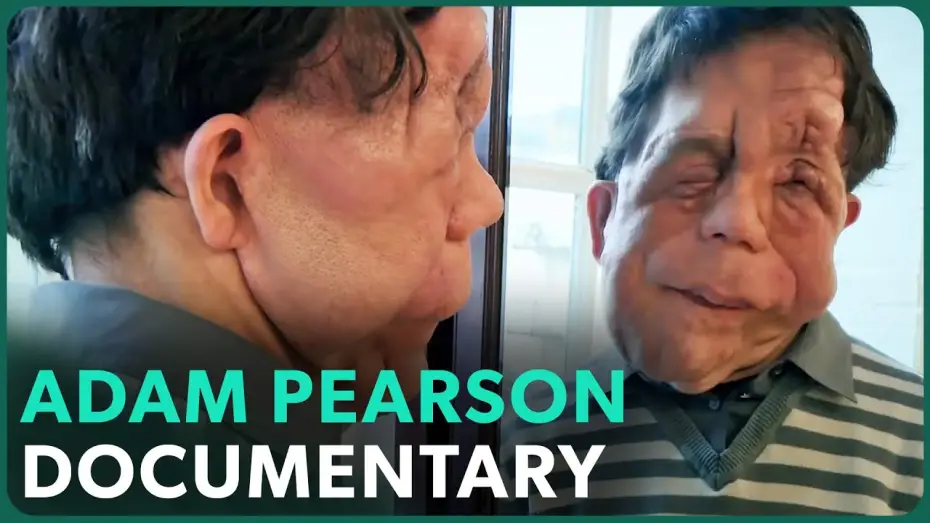 Watch film The Ugly Face of Disability Hate Crime | The Ugly Face of Disability Hate Crime (Adam Pearson Documentary) | Real Stories