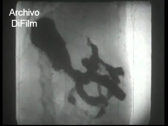 Watch film R&ouml;ntgenstrahlen | DiFilm - Los rayos X - Un film cultural de la UFA 1937