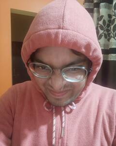 Anuj Shinde Irritation