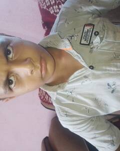 Satyam Singh Irritation