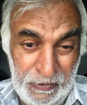 Rampal Singh Tiredness